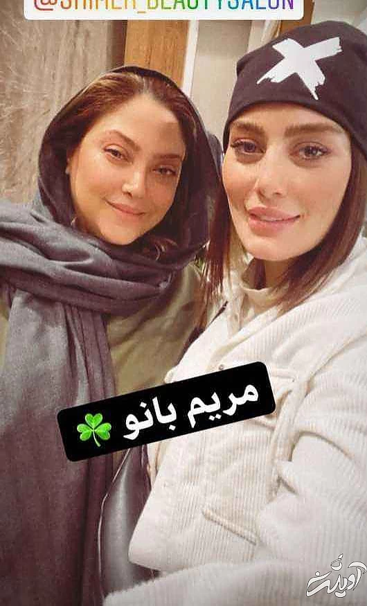  عکس - سحر قریشی خودش را زشت کرد - بلای ناگوار عمل زیبایی بر سر خانم بازیگر جذاب !